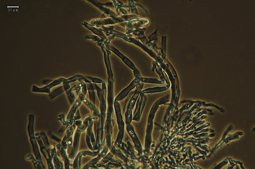 Lavoro - Crosta foto 0577 (Dacryobolus sudans)